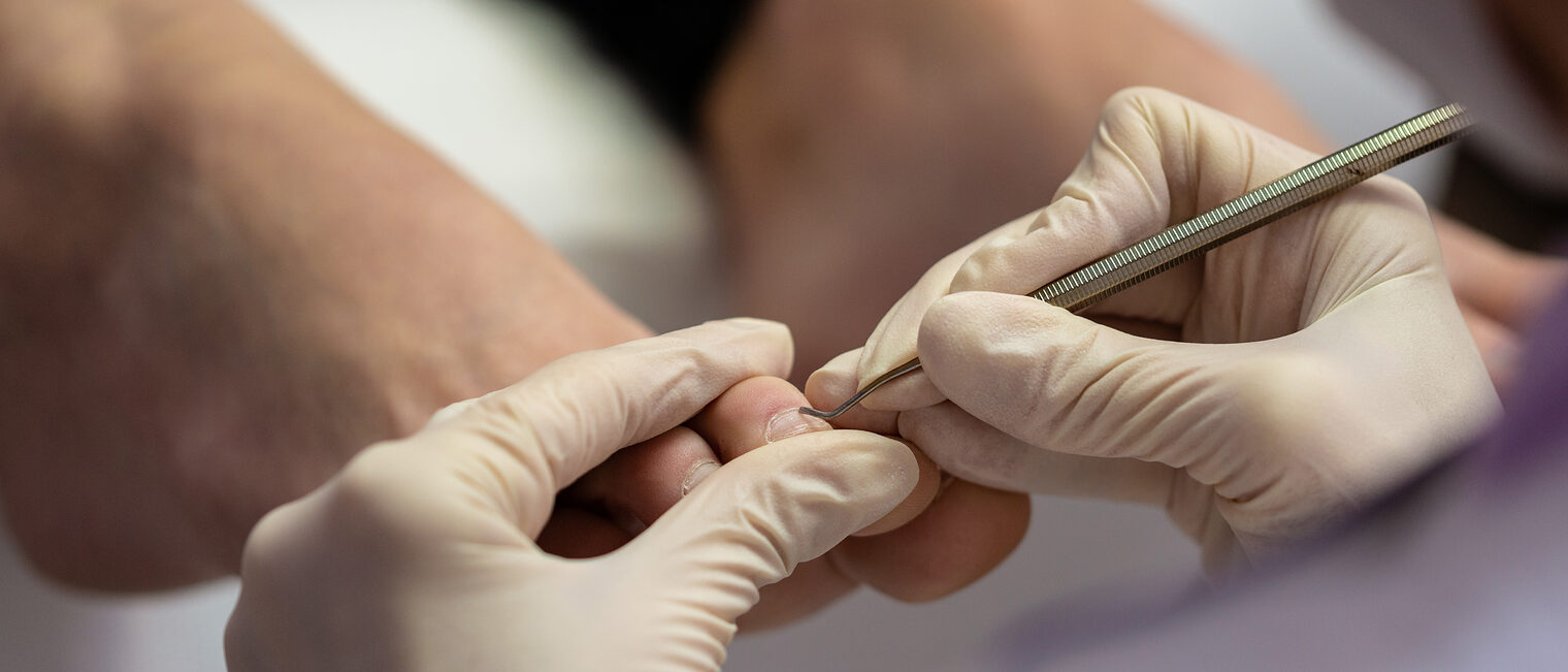 Closeup view of pedicurist removing dead skin from toenails with a professional cosmetic tool. Schlagwort(e): cosmetics, pedicure, steel, tool, hook, stainless, care, pedicurist, health, making, treatment, gloves, closeup, working, toe, nails, toenails, healthy, skin, cuticle, clean, beauty, nail, hygiene, metal, personal, accessories, toiletries, spa, toenail, bodycare, woman, professional, healthcare, procedure, process, life, grooming, podiatry, remove, preparation, cosmetology, beautician, service, lifestyle, detail, utensil, concept