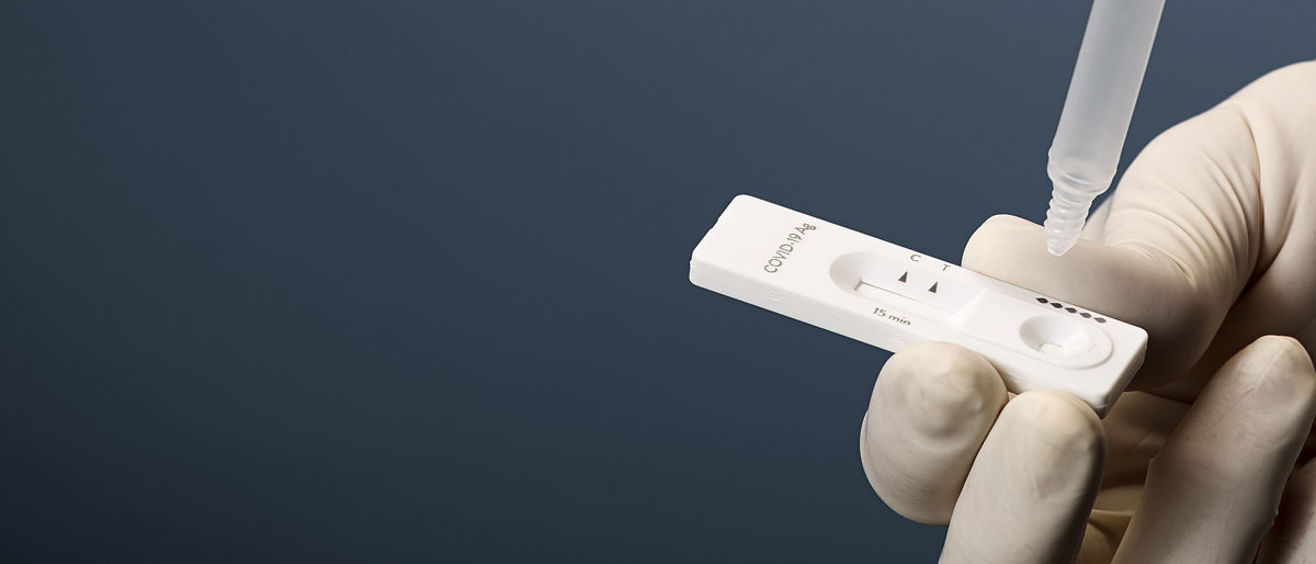 analyzing, diagnosis, igm, igg, serologic, antigen, finger prick, medic, covid19, sars, corona virus, epidemic, control, rapid, person, immunity, hand, detection, antibodies, serological, 2019-ncov, doctor, covid-19, coronavirus, disease, virus, infection, outbreak, research, pandemic, sars-cov-2, virology, medicine, health, hospital, kit, care, laboratory, test, antibody, diagnostic, lab, quarantine, pcr, corona, pneumonia, who, viral, wuhan, contagion